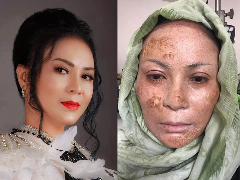 Ôn Bích Hằng: Nữ hoàng vai phụ được khán giả nhớ đến nhiều hơn cả dàn cast chính - Hình 7